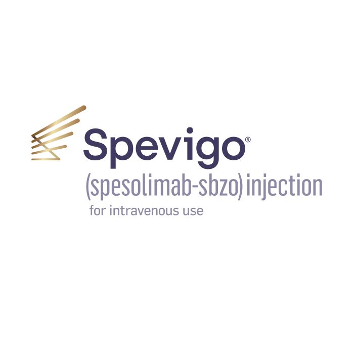 Spevigo