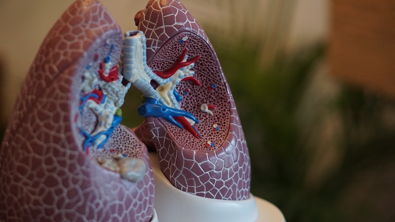 Fruquintinib como tratamento do cancro do pulmão: Já chegámos lá?